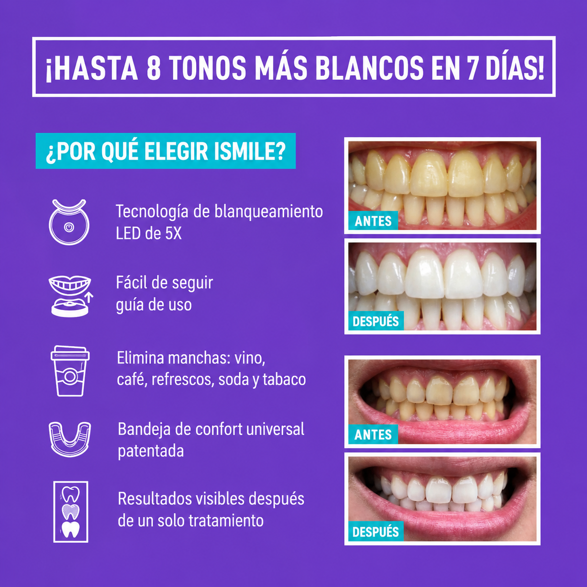iSmile Pro — Peróxido 35% sin sensibilidad dental