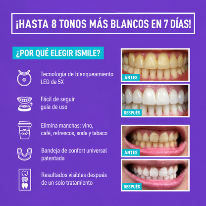 iSmile Pro — Peróxido 35% sin sensibilidad dental